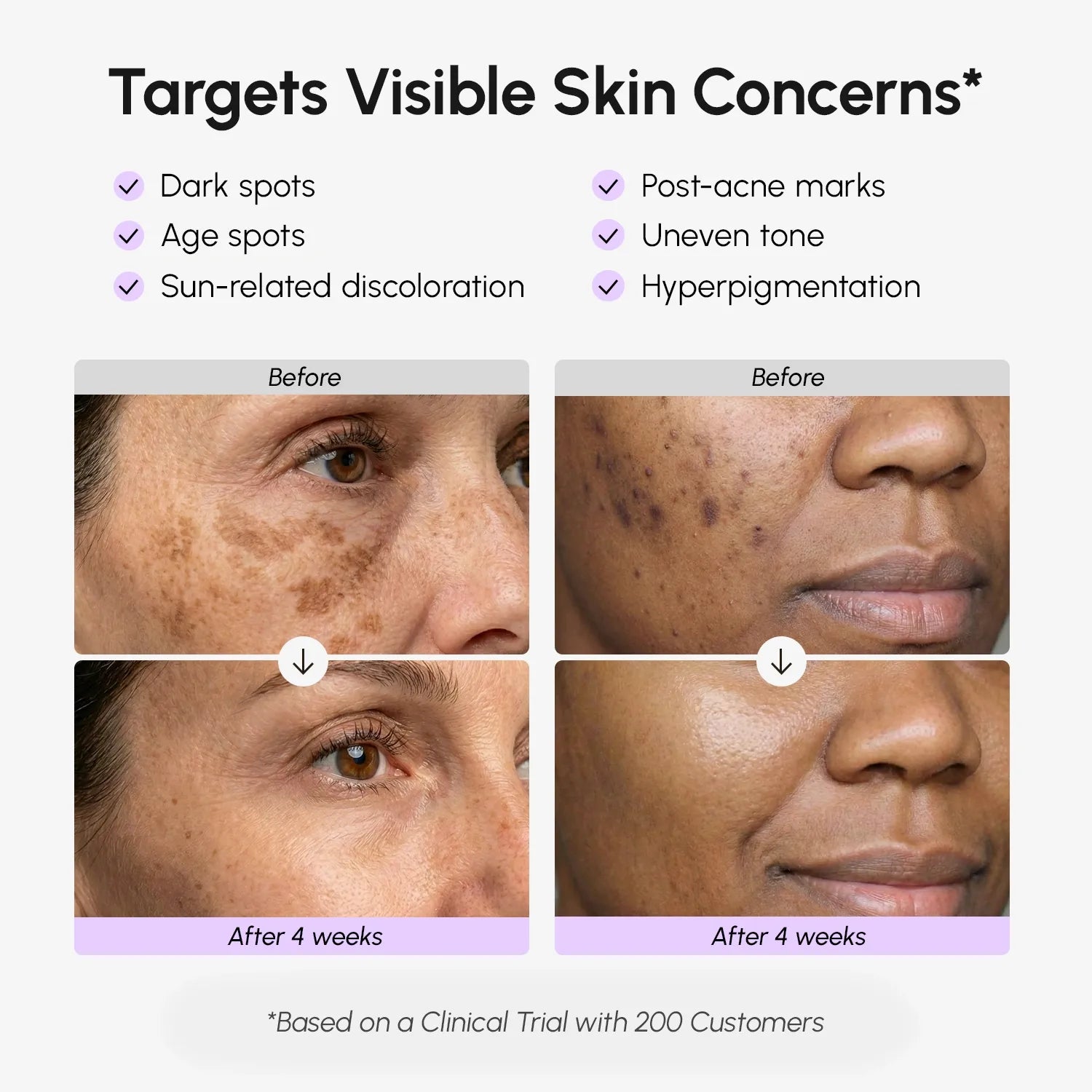 Marée® Face & Body Serum reducing dark spots, hyperpigmentation, with Tranexamic Acid and Vitamin C for even, glowing skin