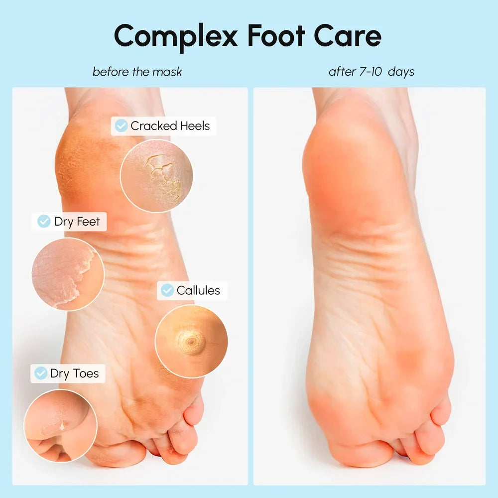 Marée 3-in-1 exfoliating and hydrating foot mask with coconut oil removing dry skin