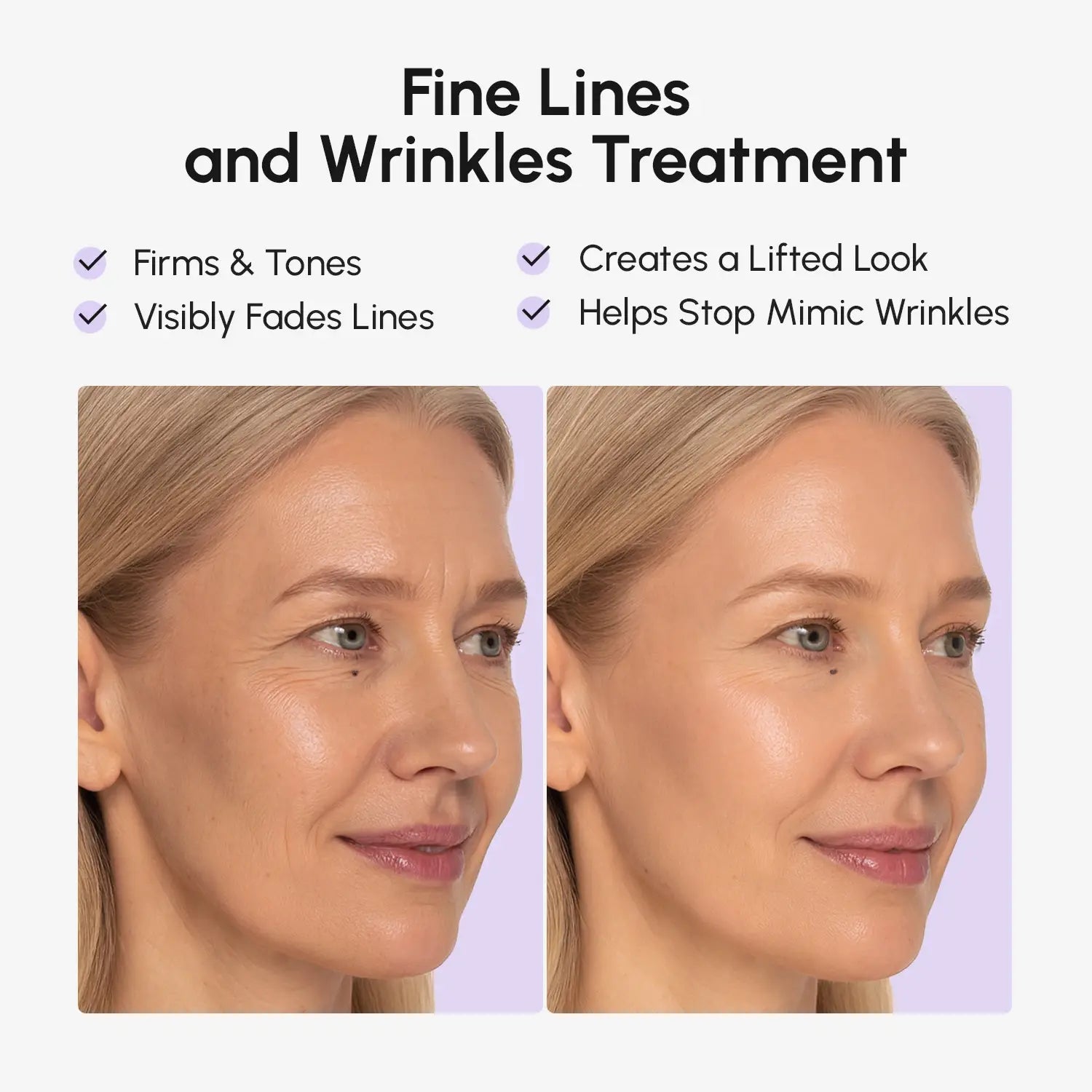 Anti-wrinkle tape patches smoothing facial wrinkles and expression lines for a youthful look